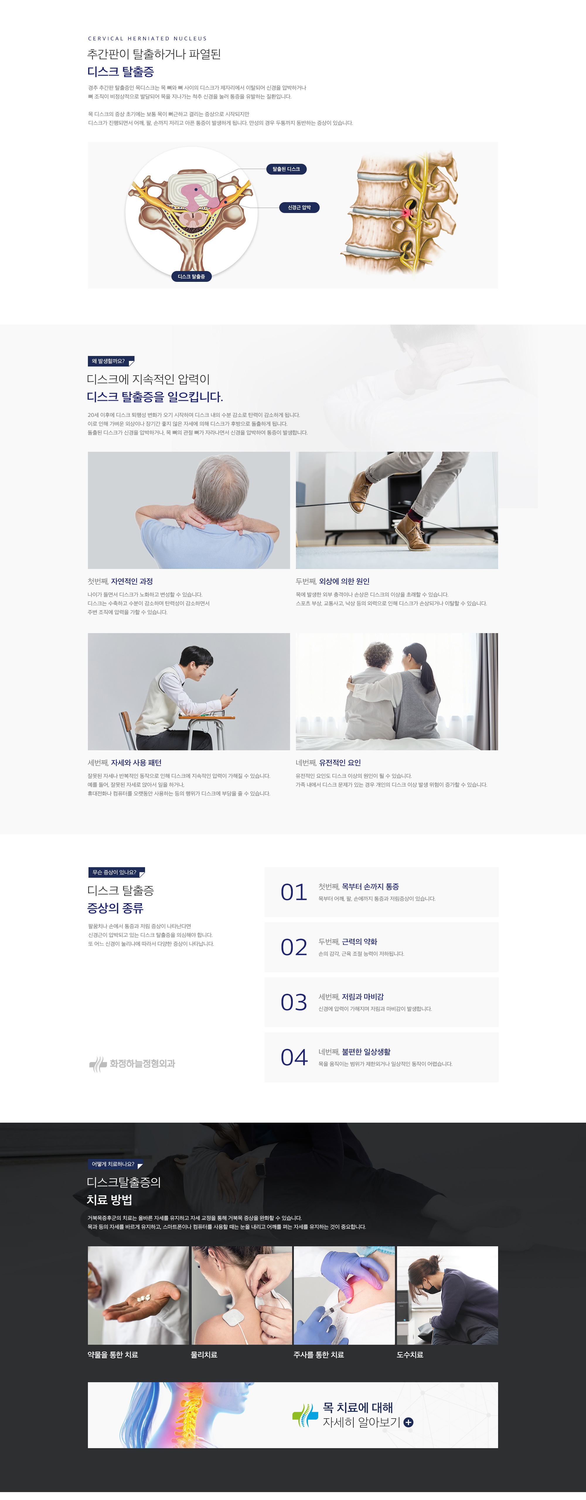 디스크탈출증